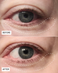 SpoiledChild H30 Fibroquin™Eye Cream | Fibroquin™ + Retinoid + Peptides | 15ml